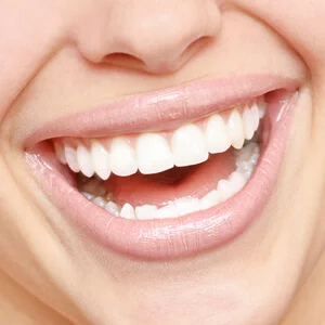 How Much Does It Cost for Dental Implants?