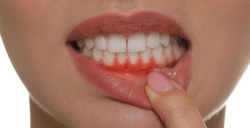 How Gum Disease Can Affect Chronic Conditions
